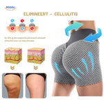 flexfit soorten cellulite die verschillende texturen en verschijningen tonen